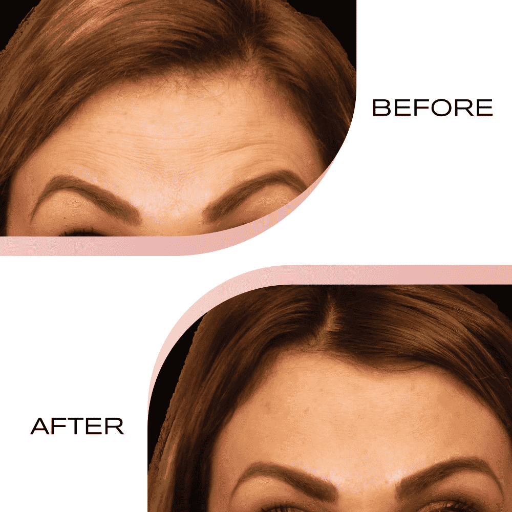 Before and After v1.1_3